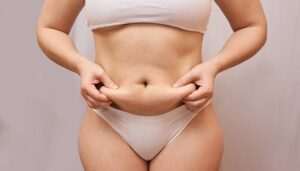 як швидко прибрати целюліт